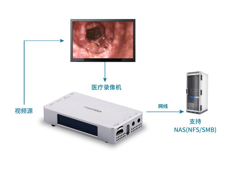 超高清4K医疗录像机，轻便型 - 图片 4